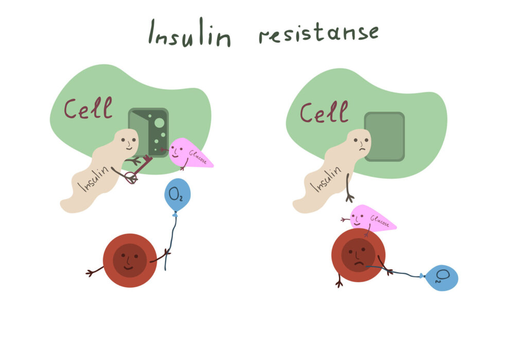 Insulin resistance illustration